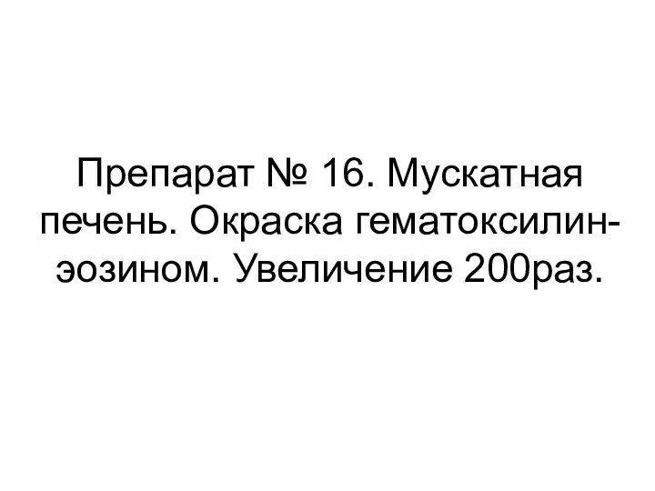 Препарат № 16. Мускатная печень. Окраска гематоксилин-эозином. Увеличение 200раз.