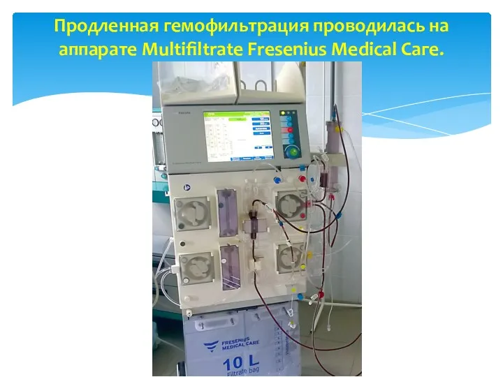 Продленная гемофильтрация проводилась на аппарате Multifiltrate Fresenius Medical Саге.