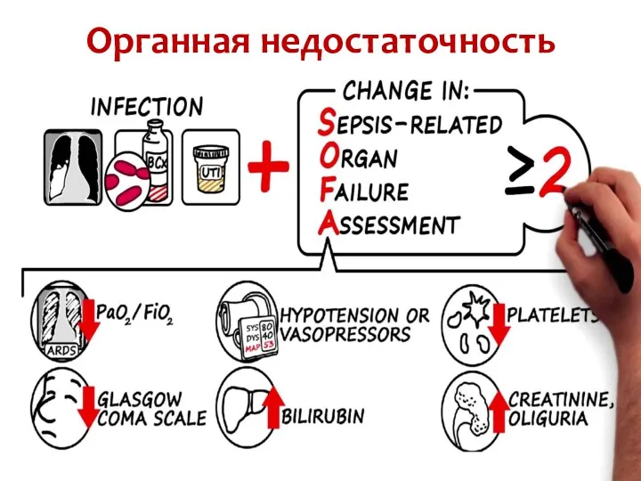 Органная недостаточность