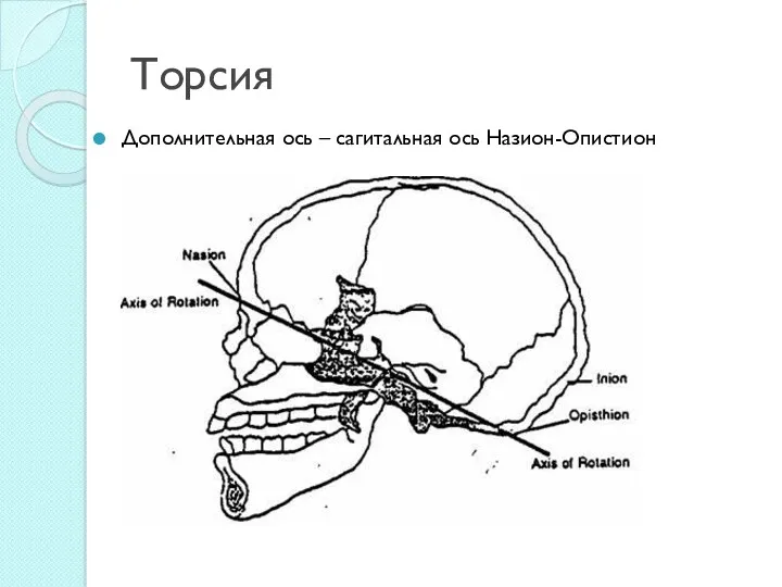 Торсия Дополнительная ось – сагитальная ось Назион-Опистион