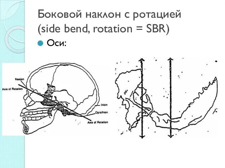 Боковой наклон с ротацией (side bend, rotation = SBR) Оси: