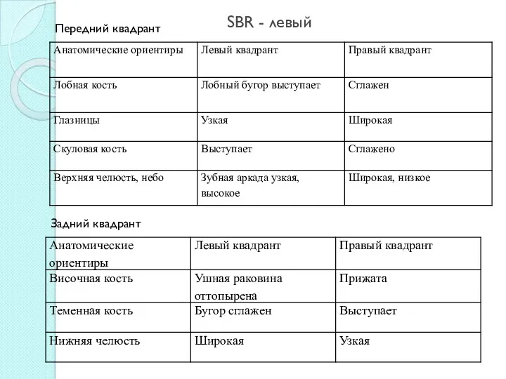 SBR - левый Задний квадрант Передний квадрант