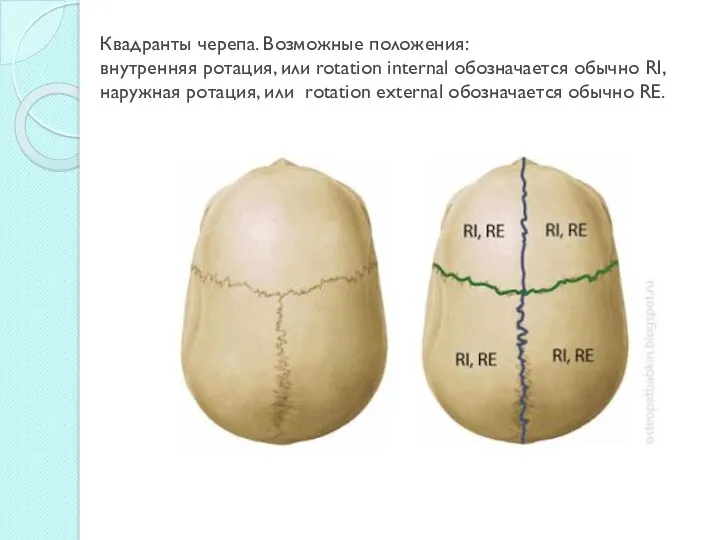 Квадранты черепа. Возможные положения: внутренняя ротация, или rotation internal обозначается обычно RI, наружная