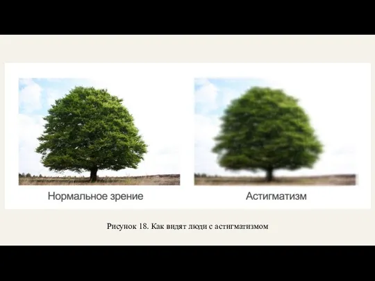 Рисунок 18. Как видят люди с астигматизмом