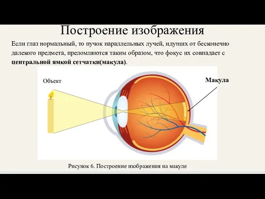 Построение изображения Если глаз нормальный, то пучок параллельных лучей, идущих