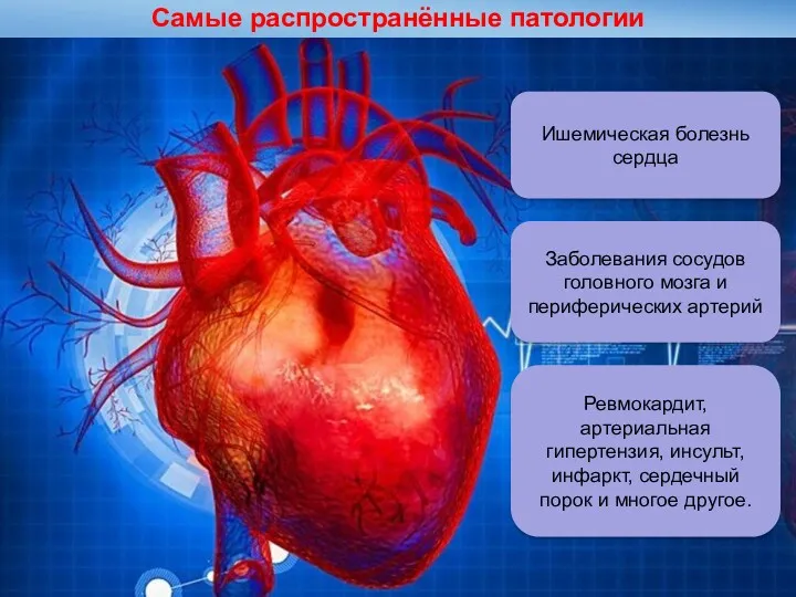 Самые распространённые патологии Ишемическая болезнь сердца Заболевания сосудов головного мозга и периферических артерий