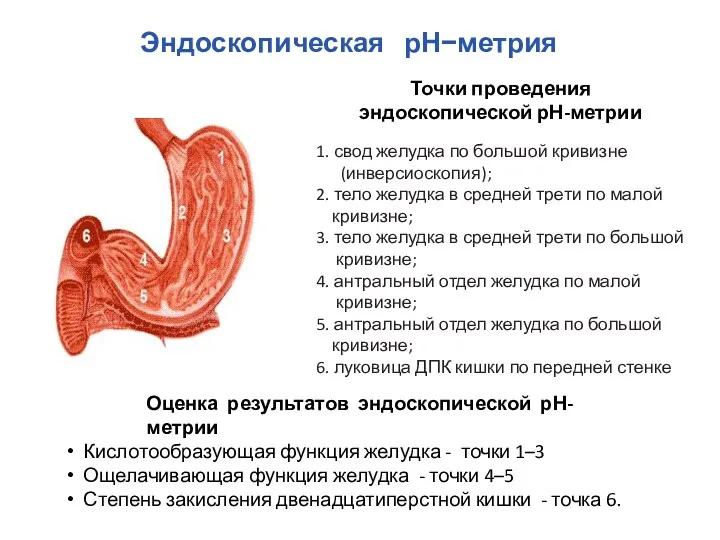 1. свод желудка по большой кривизне (инверсиоскопия); 2. тело желудка