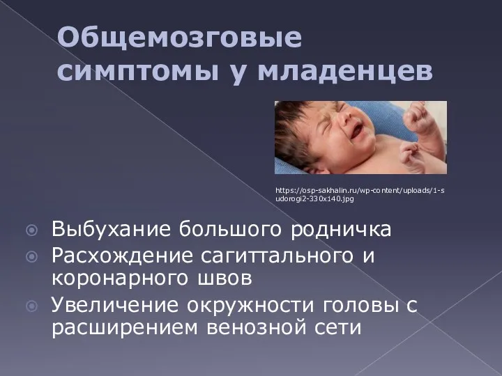 Общемозговые симптомы у младенцев Выбухание большого родничка Расхождение сагиттального и коронарного швов Увеличение