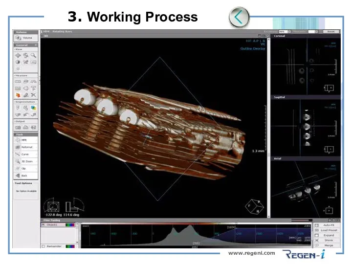 www.regeni.com 3. Working Process