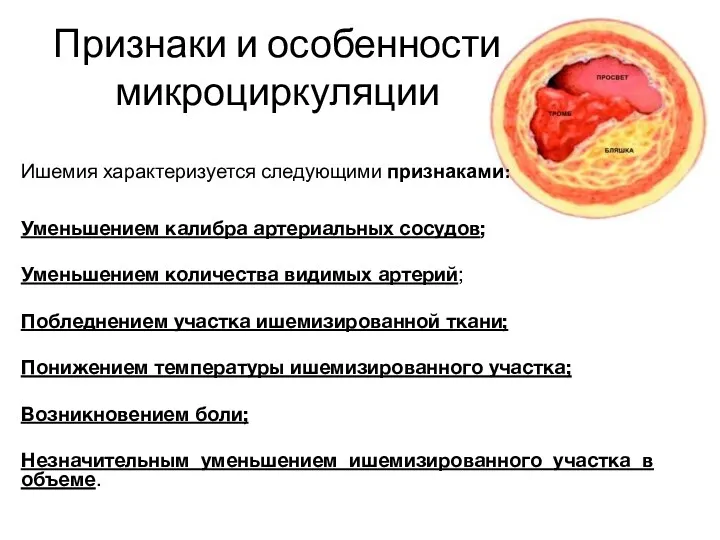 Признаки и особенности микроциркуляции Ишемия характеризуется следующими признаками: Уменьшением калибра артериальных сосудов; Уменьшением