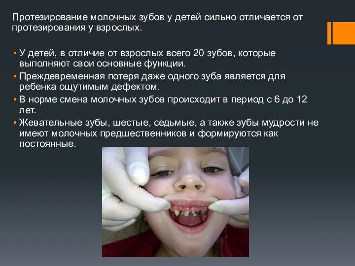 Протезирование молочных зубов у детей сильно отличается от протезирования у взрослых. У детей,