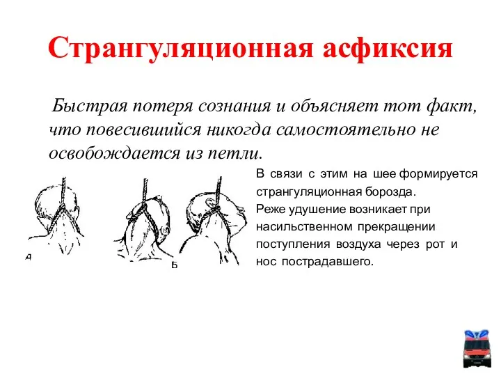 Быстрая потеря сознания и объясняет тот факт, что повесившийся никогда