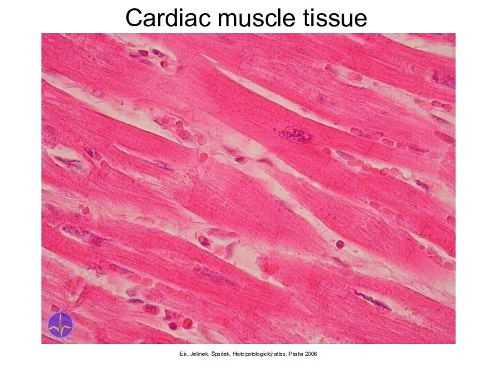 Eis, Jelínek, Špaček, Histopatologický atlas, Praha 2006 Cardiac muscle tissue