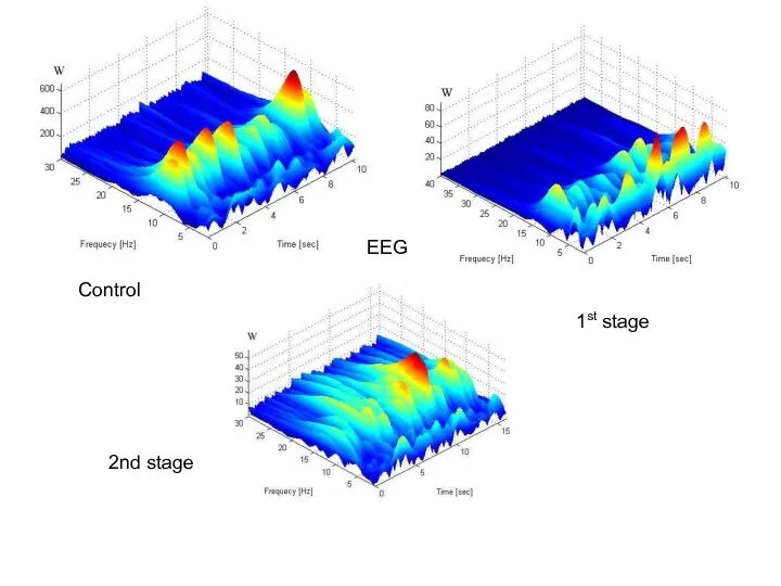 Control 1st stage 2nd stage EEG