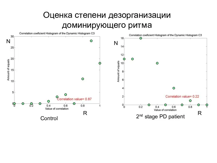 Оценка степени дезорганизации доминирующего ритма N N R R Control 2nd stage PD patient