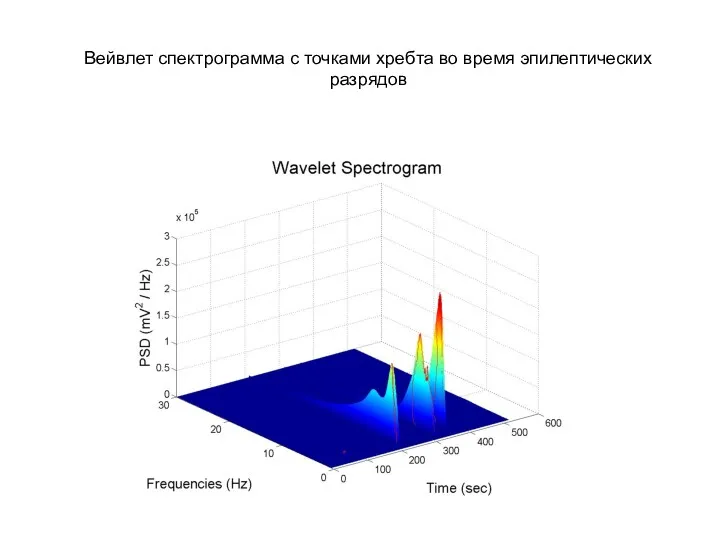 Вейвлет спектрограмма с точками хребта во время эпилептических разрядов