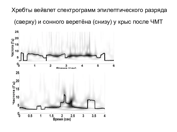Хребты вейвлет спектрограмм эпилептического разряда (сверху) и сонного веретёна (снизу) у крыс после ЧМТ