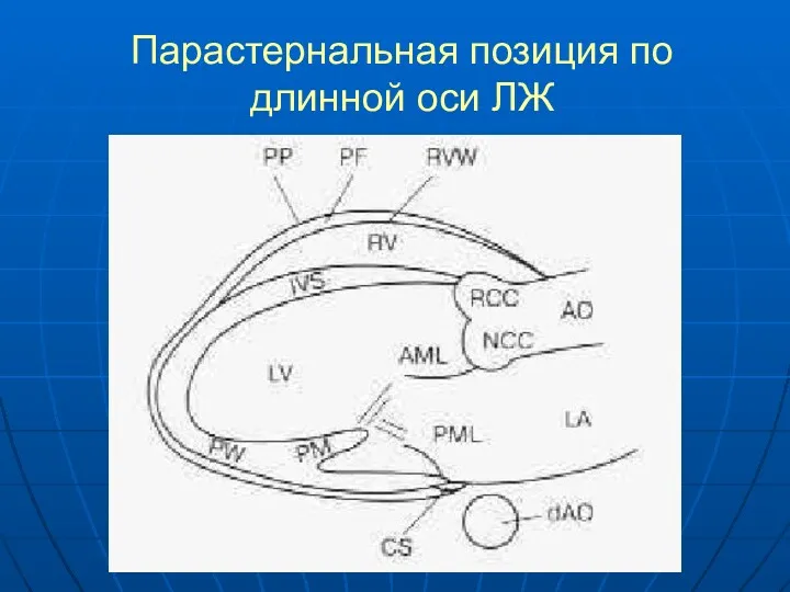 Парастернальная позиция по длинной оси ЛЖ