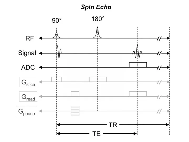 Spin Echo