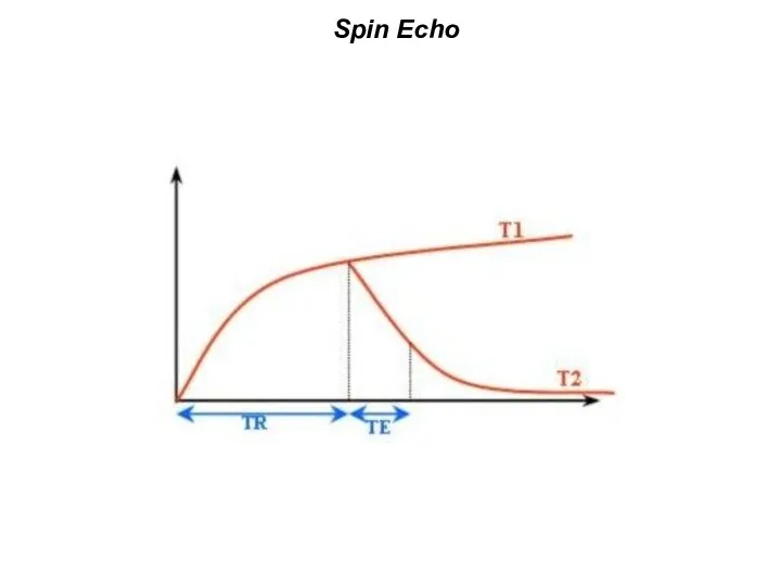 Spin Echo