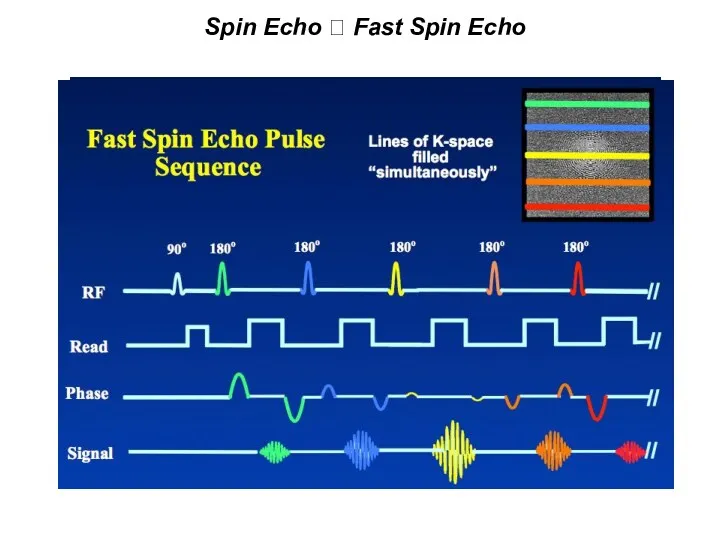 Spin Echo ? Fast Spin Echo