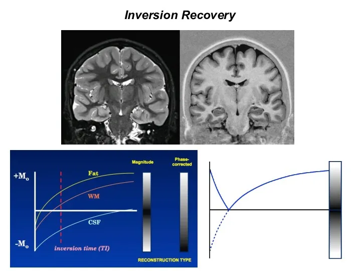 Inversion Recovery