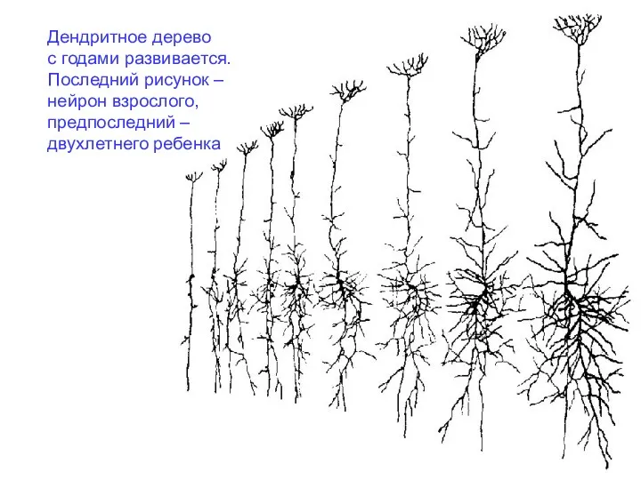 Дендритное дерево с годами развивается. Последний рисунок – нейрон взрослого, предпоследний – двухлетнего ребенка