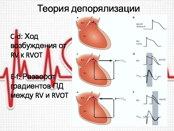 Теория депорялизации C-d: Ход возбуждения от RV к RVOT E-f: