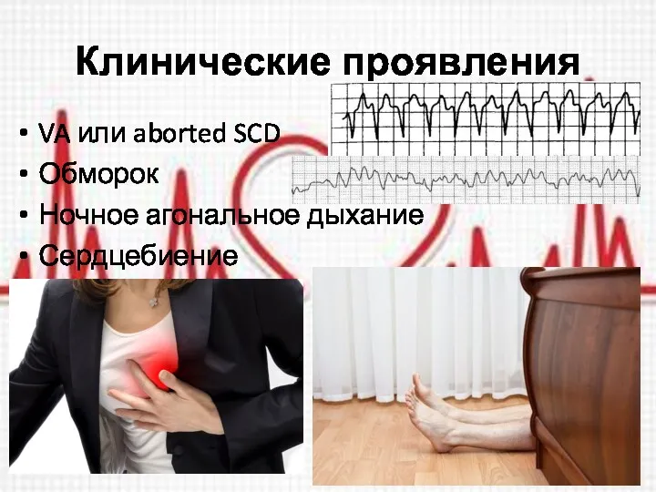Клинические проявления VA или aborted SCD Обморок Ночное агональное дыхание Сердцебиение
