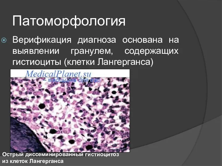 Патоморфология Верификация диагноза основана на выявлении гранулем, содержащих гистиоциты (клетки