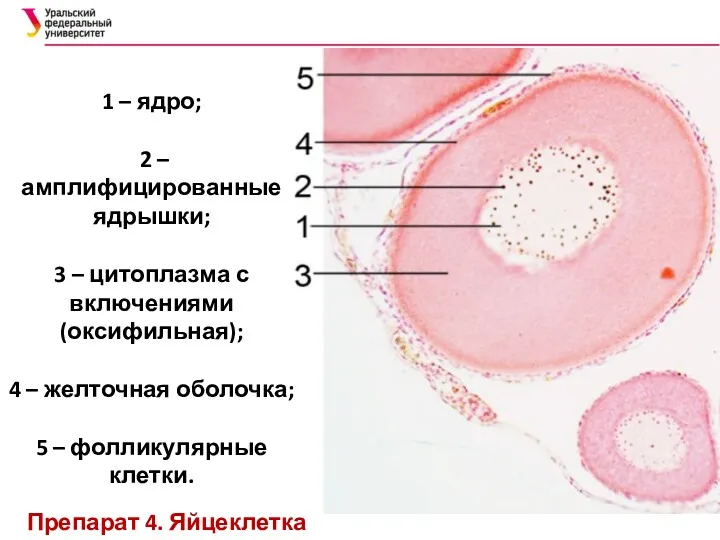 1 – ядро; 2 – амплифицированные ядрышки; 3 – цитоплазма с включениями (оксифильная);