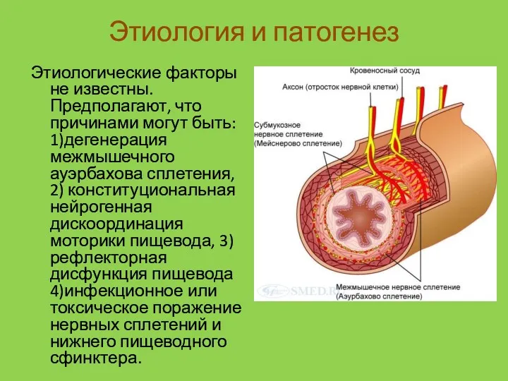 Этиология и патогенез Этиологические факторы не известны. Предполагают, что причинами