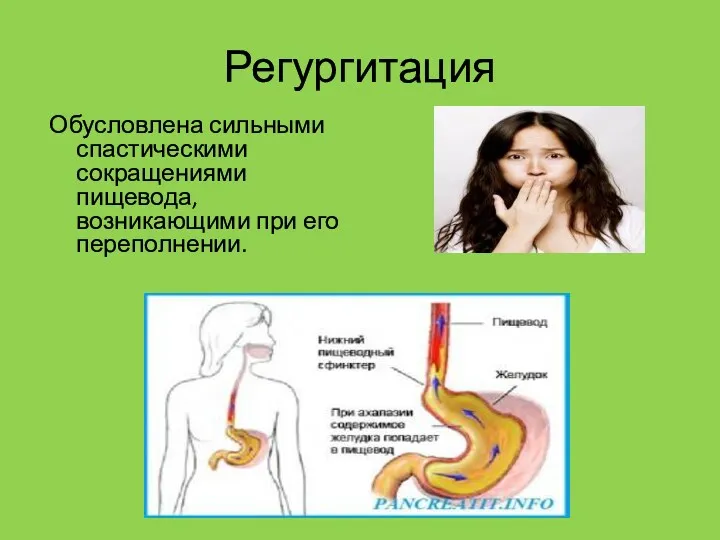 Регургитация Обусловлена сильными спастическими сокращениями пищевода, возникающими при его переполнении.