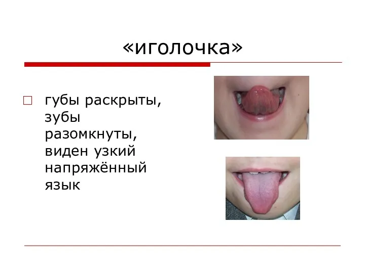 «иголочка» губы раскрыты, зубы разомкнуты, виден узкий напряжённый язык