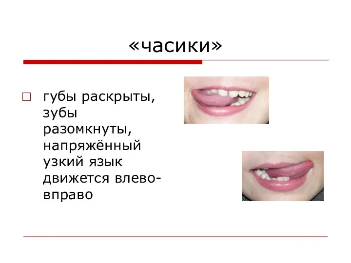 «часики» губы раскрыты, зубы разомкнуты, напряжённый узкий язык движется влево-вправо