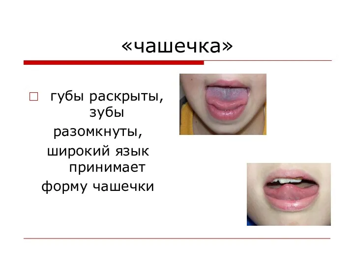 «чашечка» губы раскрыты, зубы разомкнуты, широкий язык принимает форму чашечки
