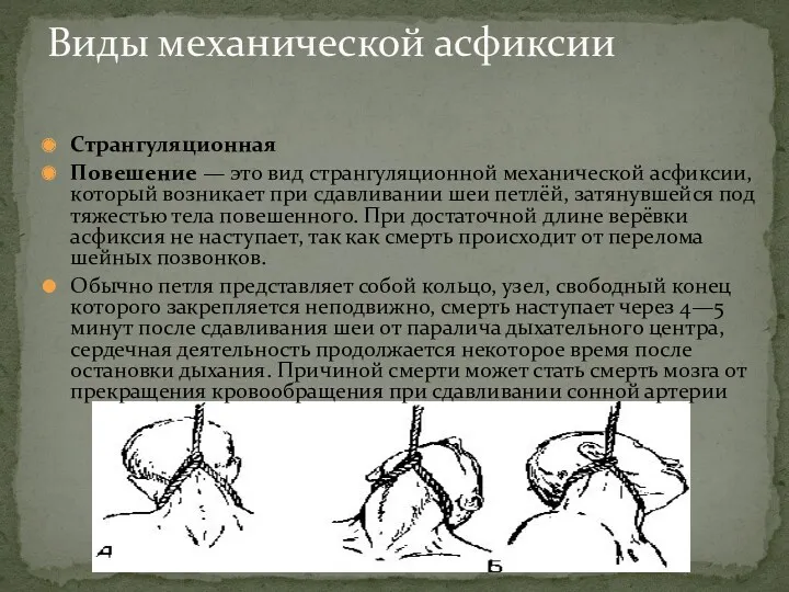 Виды механической асфиксии Странгуляционная Повешение — это вид странгуляционной механической