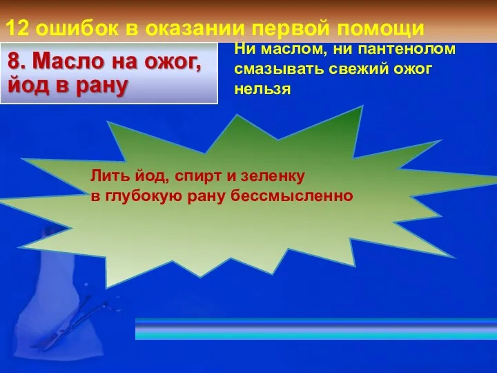 12 ошибок в оказании первой помощи Лить йод, спирт и