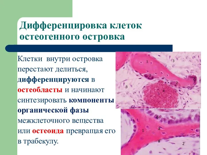 Дифференцировка клеток остеогенного островка Клетки внутри островка перестают делиться, дифференцируются в остеобласты и