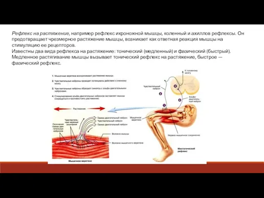Рефлекс на растяжение, например рефлекс икроножной мышцы, коленный и ахиллов