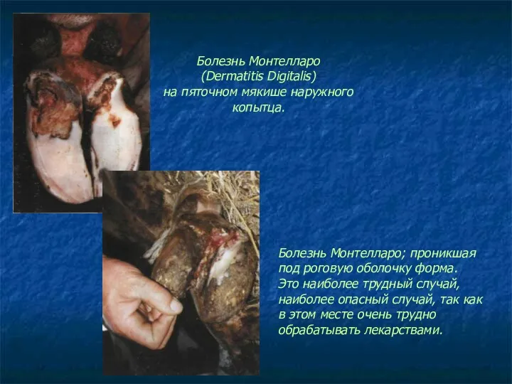 Болезнь Монтелларо (Dermatitis Digitalis) на пяточном мякише наружного копытца. Болезнь Монтелларо; проникшая под