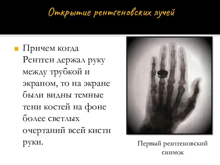 Причем когда Рентген держал руку между трубкой и экраном, то