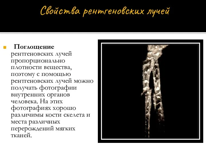 Поглощение рентгеновских лучей пропорционально плотности вещества, поэтому с помощью рентгеновских