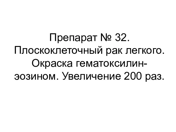 Препарат № 32. Плоскоклеточный рак легкого. Окраска гематоксилин-эозином. Увеличение 200 раз.