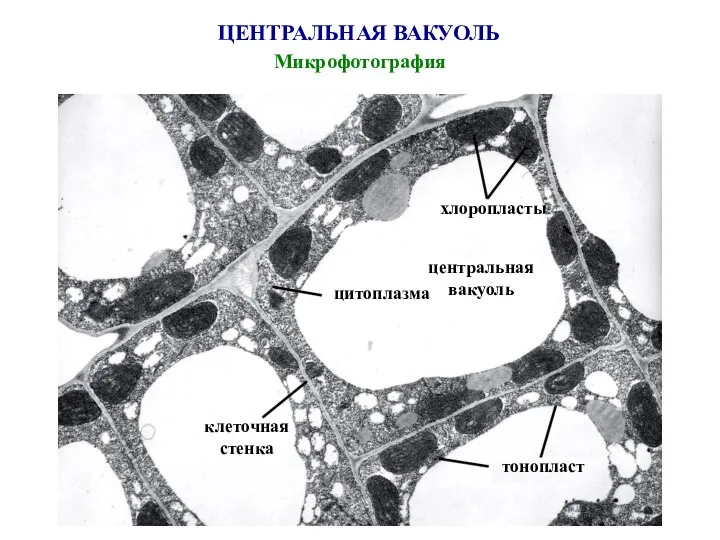 ЦЕНТРАЛЬНАЯ ВАКУОЛЬ Микрофотография хлоропласты центральная вакуоль цитоплазма клеточная стенка тонопласт