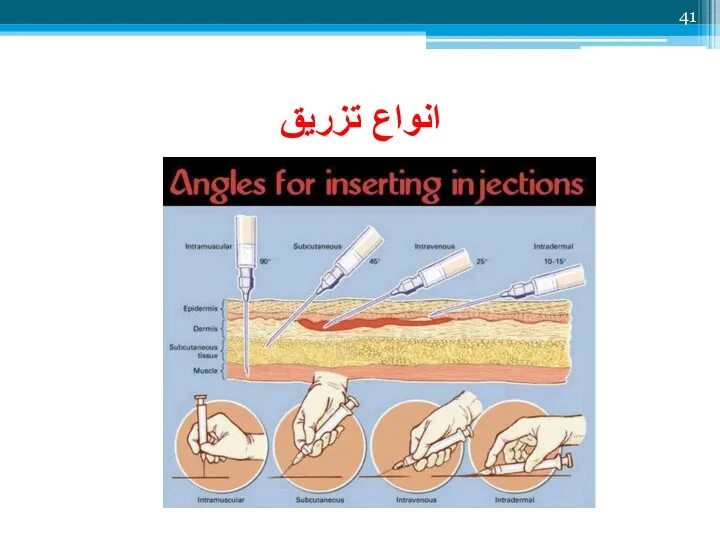 انواع تزریق