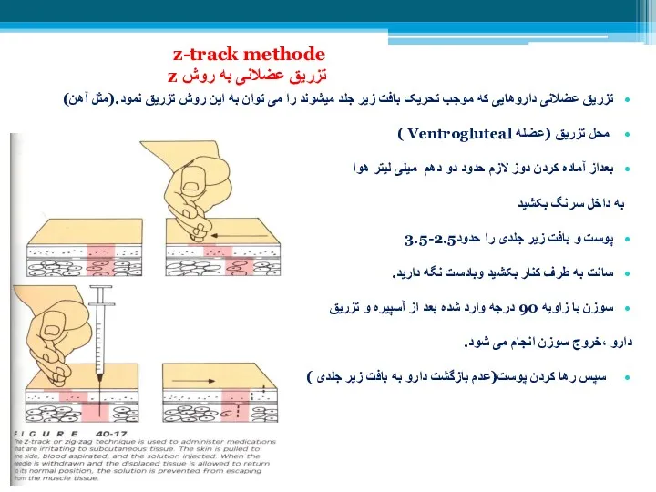 z-track methode تزریق عضلانی به روش z تزریق عضلانی داروهایی