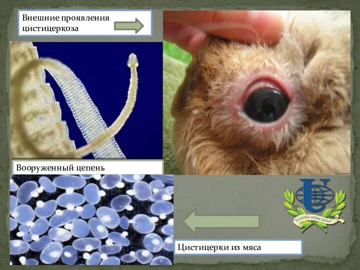 Внешние проявления цистицеркоза Вооруженный цепень Цистицерки из мяса