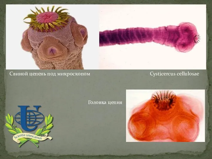 Свиной цепень под микроскопом Cysticercus cellulosae Головка цепня