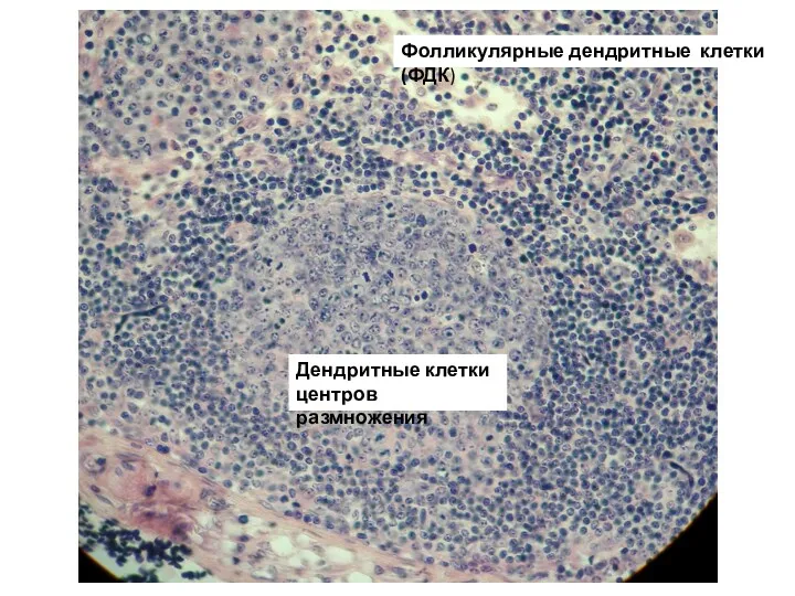 Фолликулярные дендритные клетки (ФДК) Дендритные клетки центров размножения